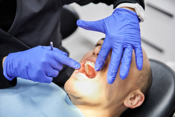 Best Emergency Wisdom Teeth Removal in Marcellus, MI